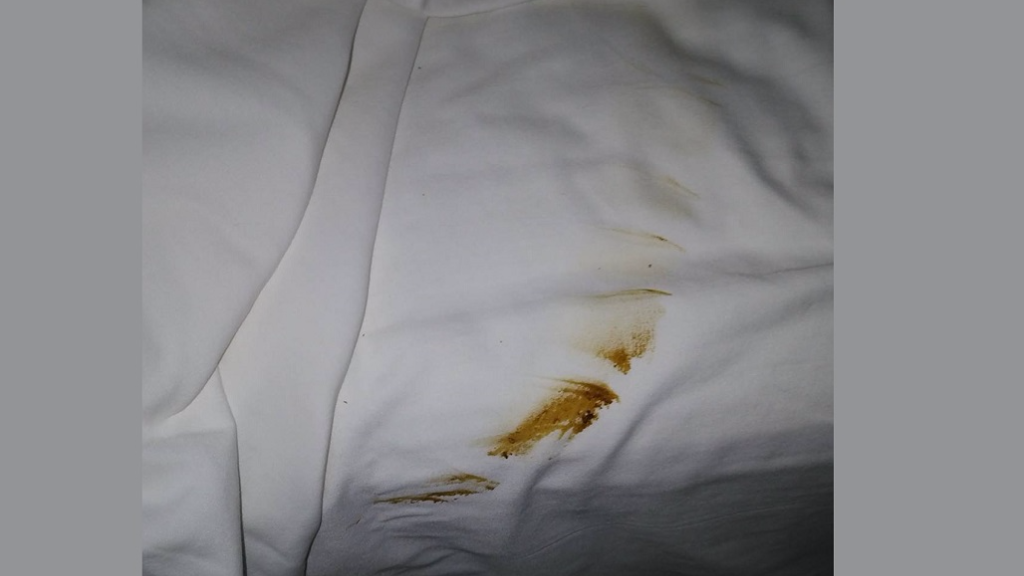 Local hotel slammed after claims of brown stains on bedsheet | Loop Trinidad & Tobago